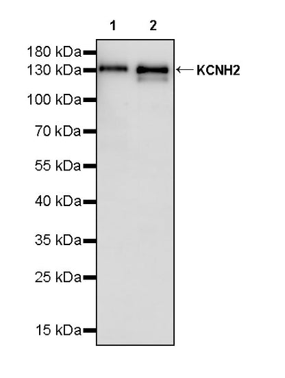 KCNH2 Recombinant Rabbit mAb (S-3727-63)