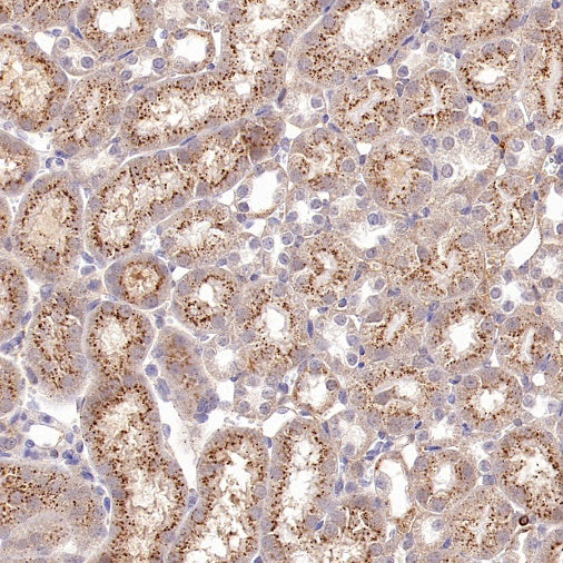 beta Galactosidase/GLB1 Recombinant Rabbit mAb (S-2295-7)