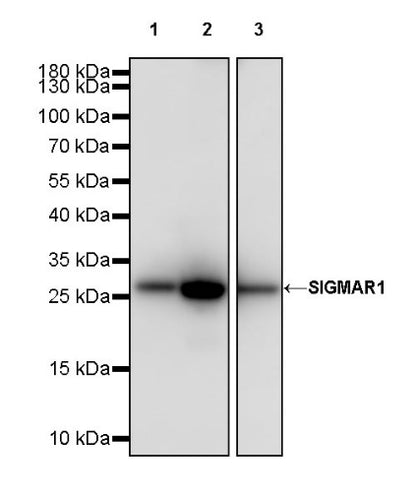 SIGMAR1 Recombinant Rabbit mAb (S-2079-270)