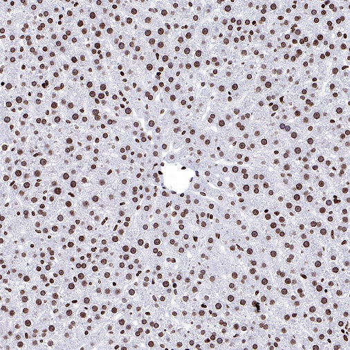 Histone H3 (di methyl K56) Recombinant Rabbit mAb (S-R427)