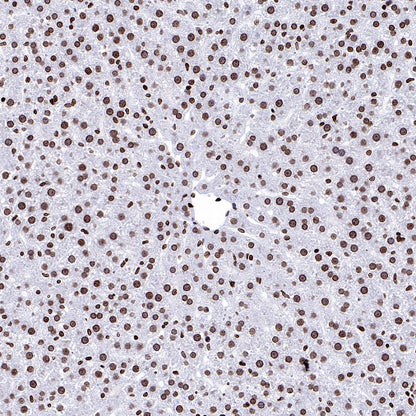 Histone H3 (di methyl K56) Recombinant Rabbit mAb (S-R427)