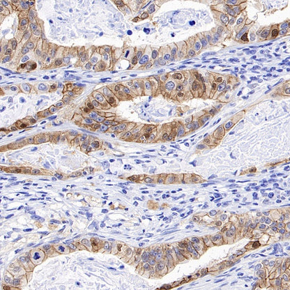 Non-phospho (Active) β-Catenin (Ser37/Thr41) Recombinant Rabbit mAb (S-1813-42)