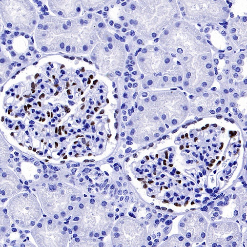 FOXC1 Recombinant Rabbit mAb (S-1607-142)