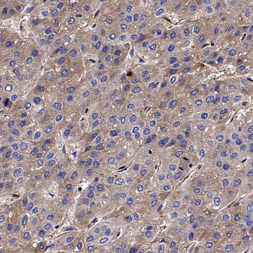 CD59 Mouse mAb (S-936-1)