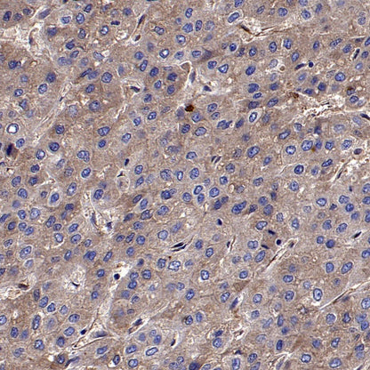 CD59 Mouse mAb (S-936-1)