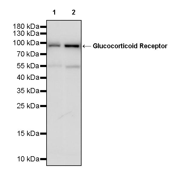 Glucocorticoid Receptor Recombinant Rabbit mAb (S-M0030)