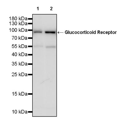 Glucocorticoid Receptor Recombinant Rabbit mAb (S-M0030)