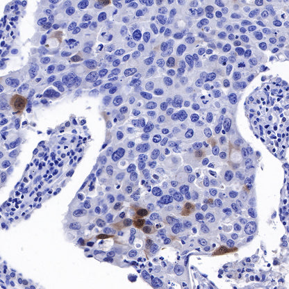 NY-ESO-1 Recombinant Rabbit mAb (SDT-R154)