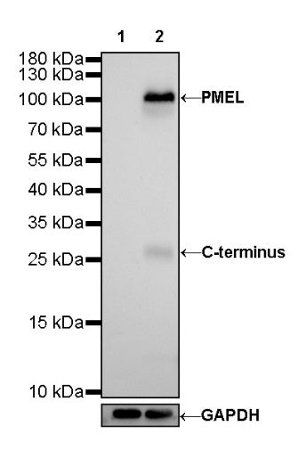 PMEL/Melanoma gp100 Recombinant Rabbit mAb (SDT-434-70)