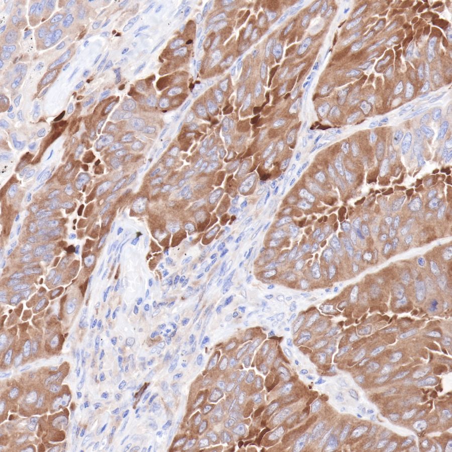 Hsp90 beta Recombinant Rabbit mAb (SDT-R033)