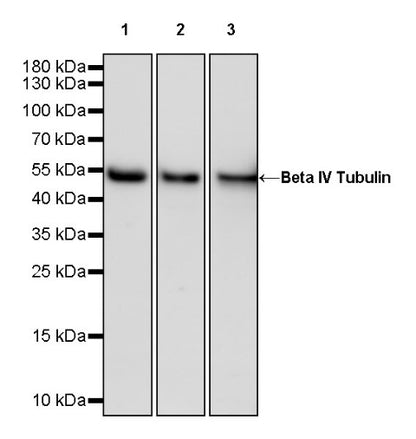 Beta IV Tubulin Recombinant Rabbit mAb (S-1572-30)