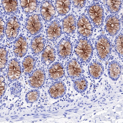 MUC4 Recombinant Rabbit mAb (SDT-841-13)