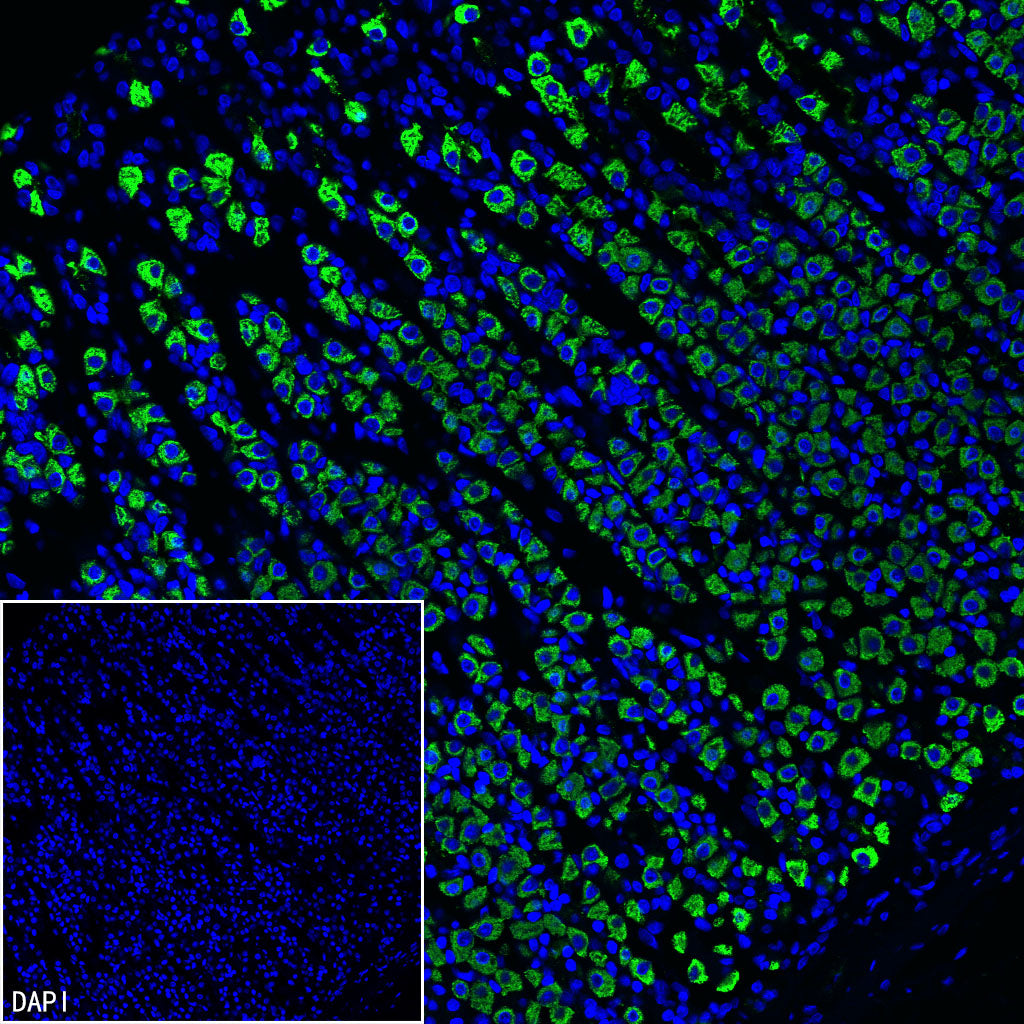 H+/K+-ATPase Recombinant Rabbit mAb (S-3474-110)