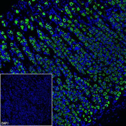 H+/K+-ATPase Recombinant Rabbit mAb (S-3474-110)