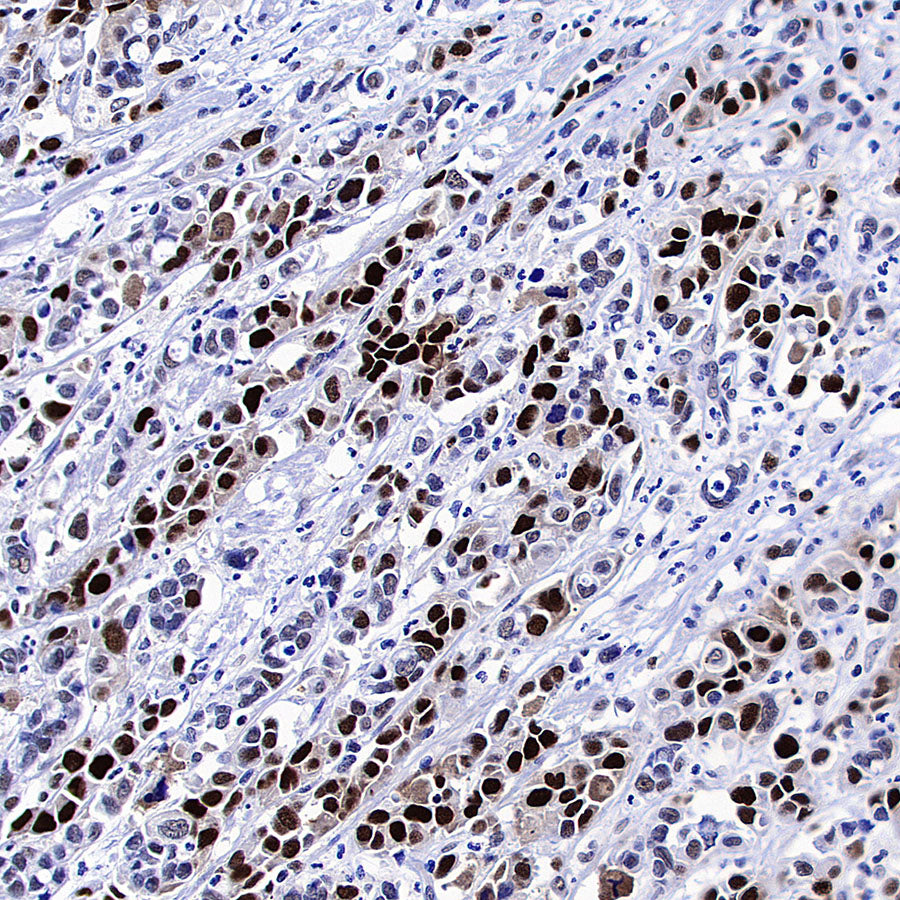 PCNA Recombinant Rabbit mAb (S-5313)