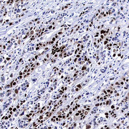 PCNA Recombinant Rabbit mAb (S-5313)