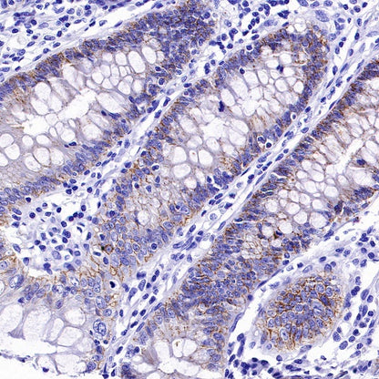 Claudin 3+Claudin 9 Recombinant Rabbit mAb (SDT-1452-80)