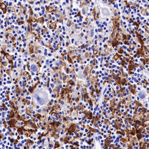 CD163 Recombinant Rabbit mAb (SDT-222-171)