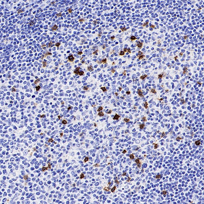 CD57 Mouse mAb (S-R571)