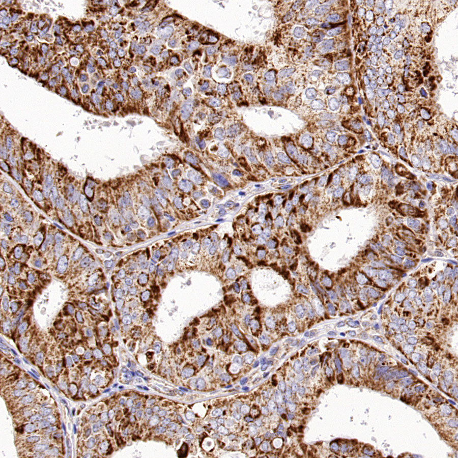 VDAC3 Rabbit Polyclonal Antibody