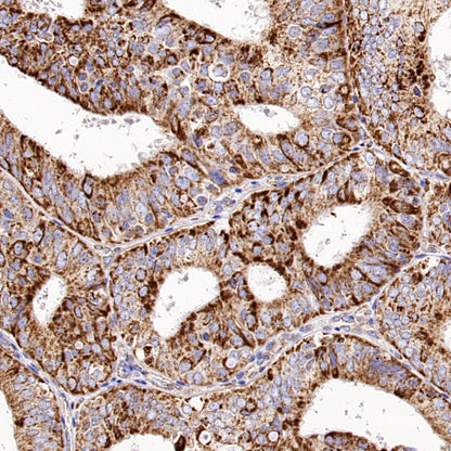 VDAC3 Rabbit Polyclonal Antibody