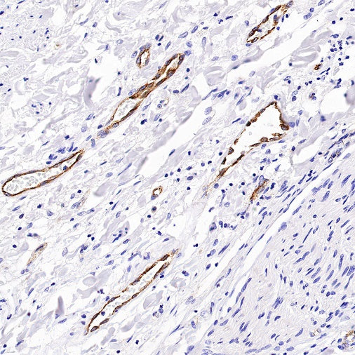 Von Willebrand Factor Recombinant Rabbit mAb (S-663-120)