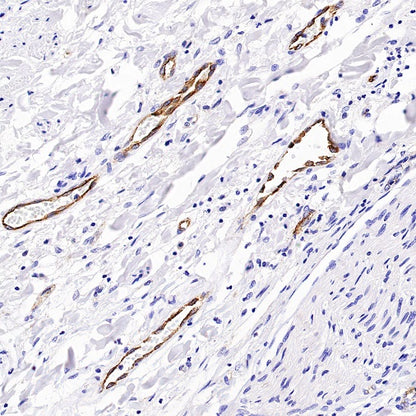 Von Willebrand Factor Recombinant Rabbit mAb (S-663-120)