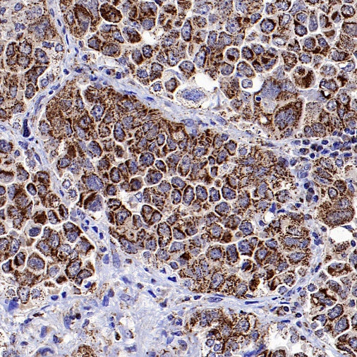 Fumarate hydratase Rabbit Polyclonal Antibody
