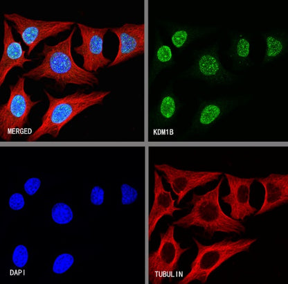 KDM1B Recombinant Rabbit mAb (S-993-8)