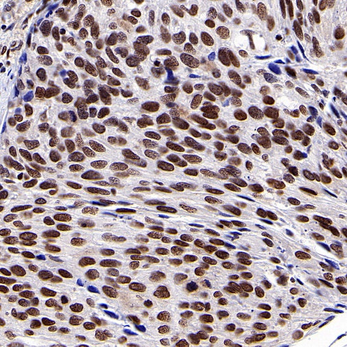 SUMO-1 Recombinant Rabbit mAb (S-625-111)