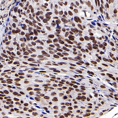 SUMO-1 Recombinant Rabbit mAb (S-625-111)
