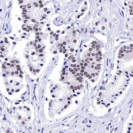 METTL3 Recombinant Rabbit mAb (S-315-219)