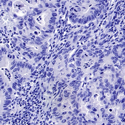 Uteroglobin Recombinant Rabbit mAb ,PBS Only(SDT-2736-46)