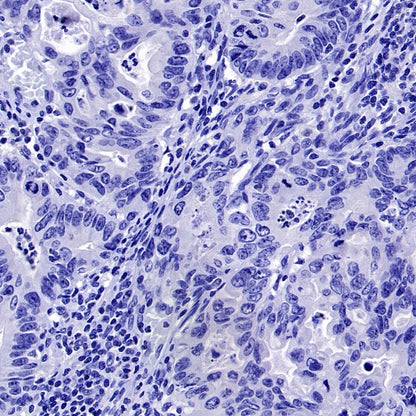 Uteroglobin Recombinant Rabbit mAb ,PBS Only(SDT-2736-46)
