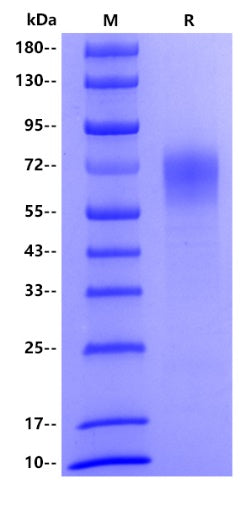 Human CD39, His tag