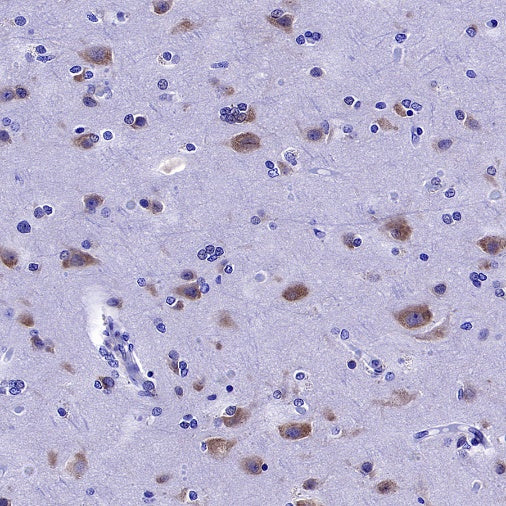 YTHDF1 Recombinant Rabbit mAb (S-2443-28)