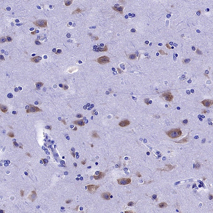 YTHDF1 Recombinant Rabbit mAb (S-2443-28)
