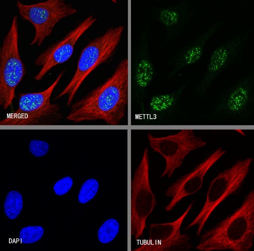 METTL3 Recombinant Rabbit mAb (S-315-219)