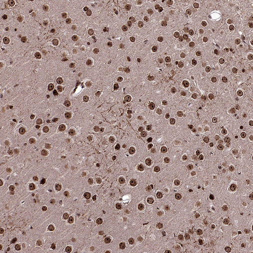 Fibrillarin Recombinant Rabbit mAb (S-1718-171)
