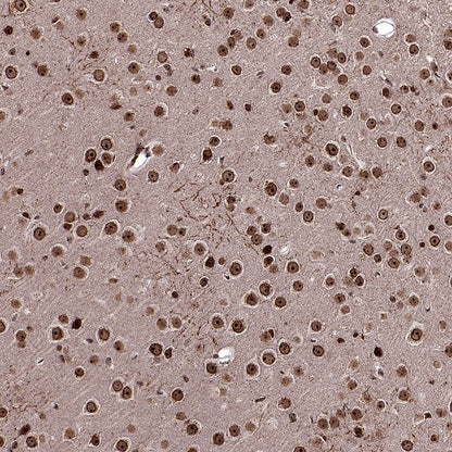 Fibrillarin Recombinant Rabbit mAb (S-1718-171)