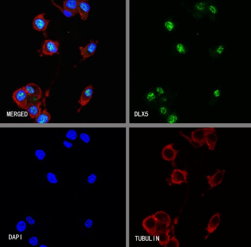 DLX5 Recombinant Rabbit mAb (S-2785-79)