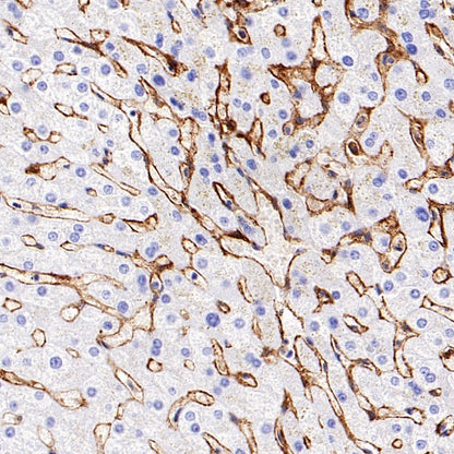 MARCKS Recombinant Rabbit mAb (S-3190-72)
