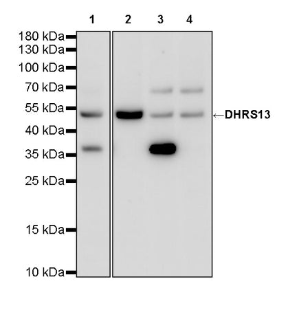 CYP1B1 Recombinant Rabbit mAb (S-6022)