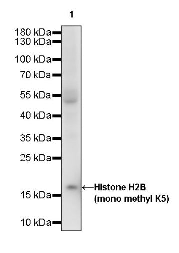 Histone H2B (mono methyl K5) Recombinant Rabbit mAb (S-1416-412)