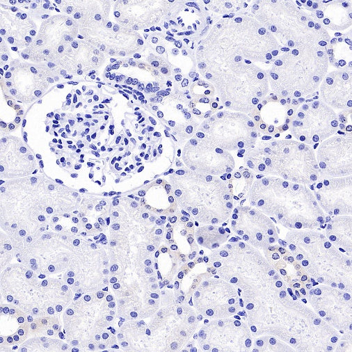 MelanA Recombinant Rabbit mAb (SDT-3352)