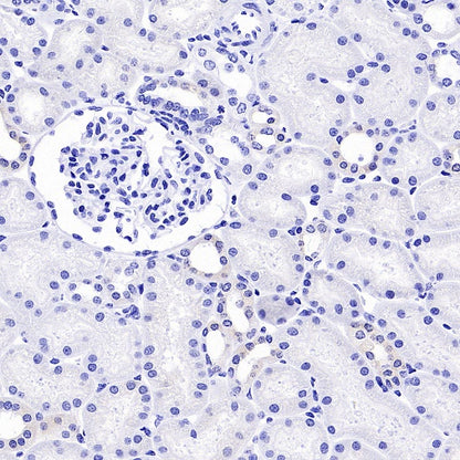 MelanA Recombinant Rabbit mAb (SDT-3352)