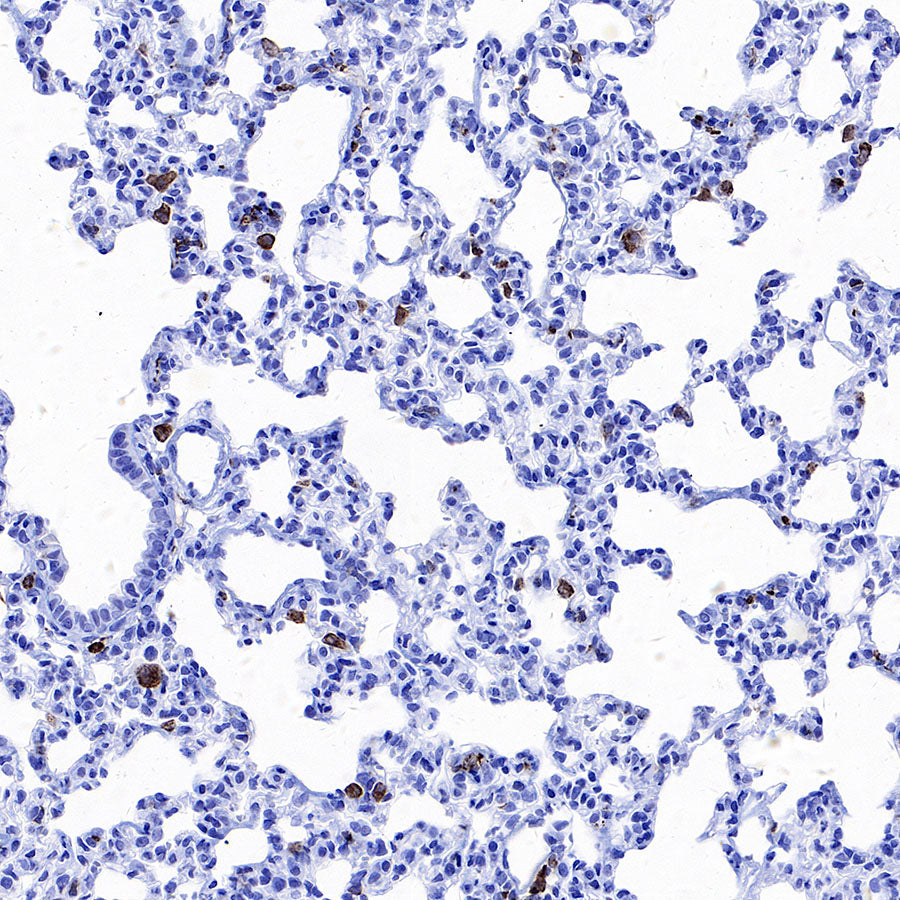 CD206 Recombinant Rabbit mAb (S-3477-27)