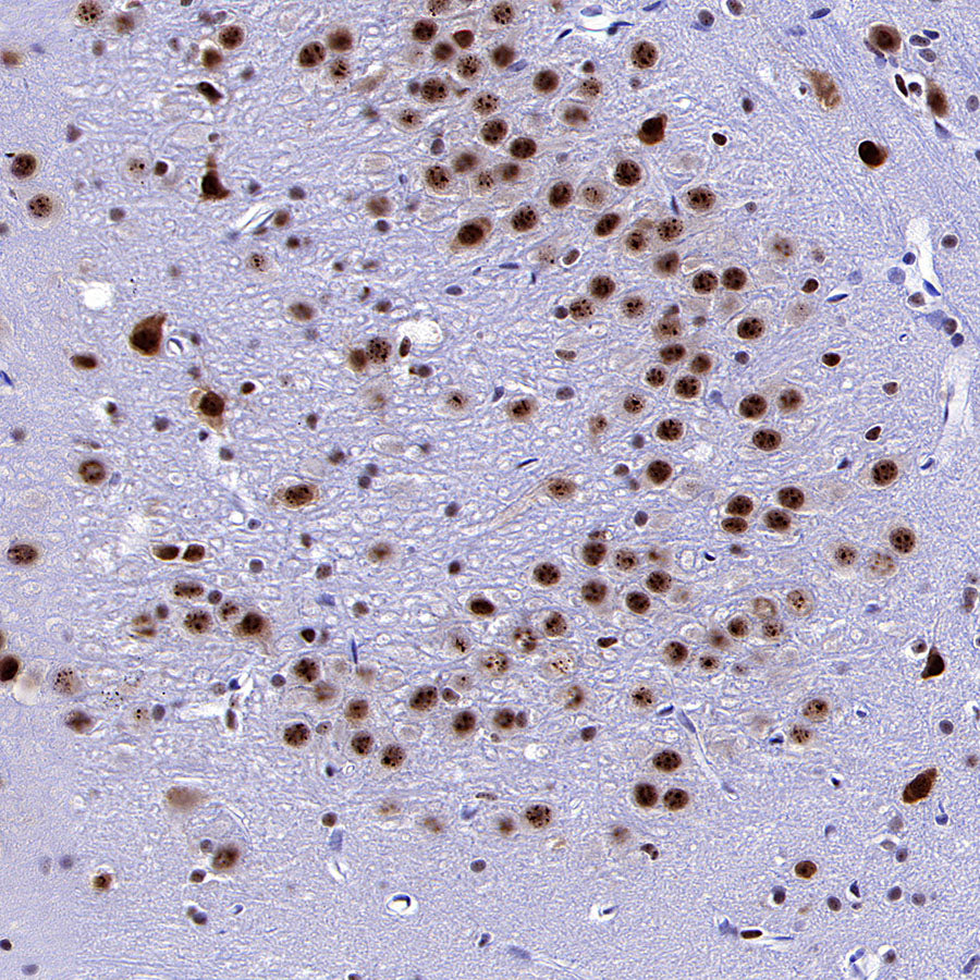NOVA1 Recombinant Rabbit mAb (S-4031-71)