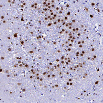 NOVA1 Recombinant Rabbit mAb (S-4031-71)