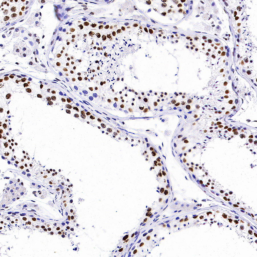 TriMethyl-Histone H3 (K36) Recombinant Rabbit mAb (S-M0025)